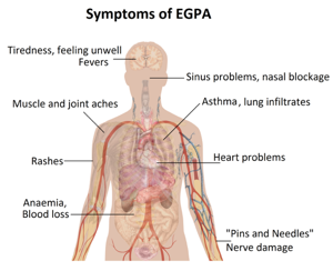 Churg Strauss Syndrome