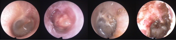 Images of the tympanic membrane