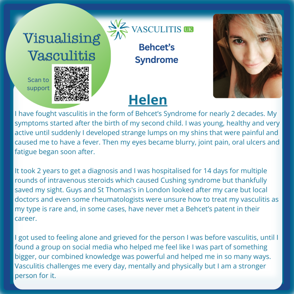 Helen's story - part of the Visualising Vasculitis series
