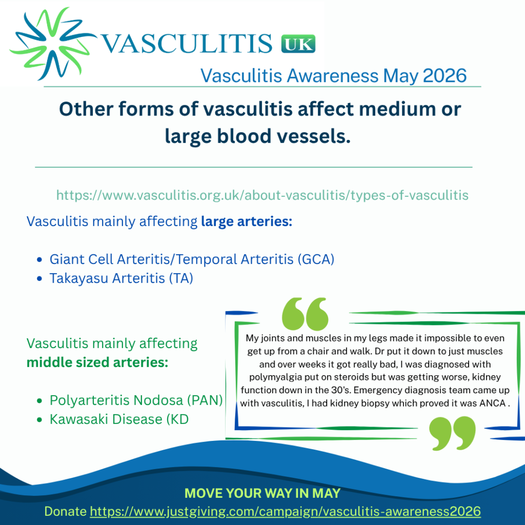 Vasculitis mainly affecting large arteries:
•	Giant Cell Arteritis/Temporal Arteritis (GCA)
•	Takayasu Arteritis (TA)
•	Vasculitis mainly affecting middle sized arteries
•	Polyarteritis Nodosa (PAN)
•	Kawasaki Disease (KD)
