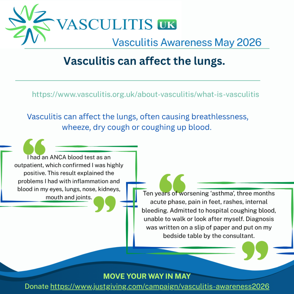 Vasculitis can affect the lungs, often causing breathlessness, wheeze, dry cough or coughing up blood.