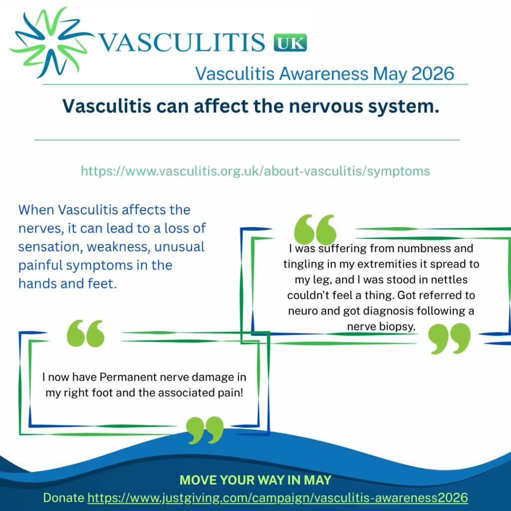 When Vasculitis affects the nerves, it can lead to a loss of sensation, weakness, unusual painful symptoms in the hands and feet.