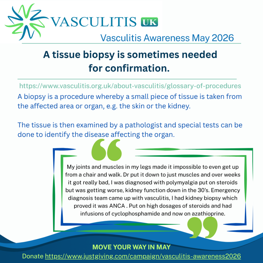 A biopsy is a procedure whereby a small piece of tissue is taken from the affected area or organ, e.g. the skin or the kidney. The tissue is then examined by a pathologist and special tests can be done to identify the disease affecting the organ.